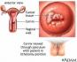 Ennosend Tightening Liquid น้ำยาทำความสะอาดจุดซ่อนเร้น
